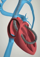 protekduo_animation